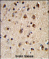 ADRBK2 Antibody (N-term)